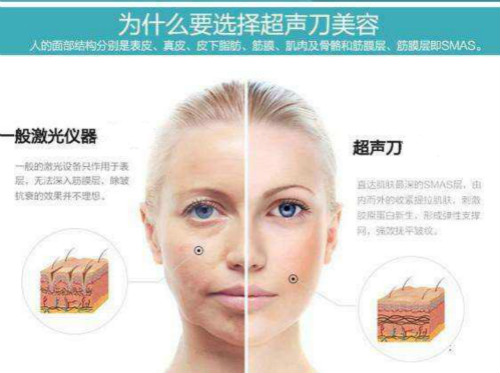 超聲刀美容儀,美容院儀器,超聲刀美容儀副作用,超聲刀美容儀價(jià)格