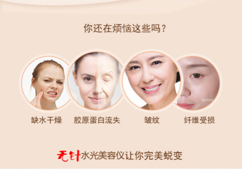 無針?biāo)饷廊輧x,美容院美容儀器,美容儀注意事項(xiàng),美容儀器護(hù)理,美容儀器廠家