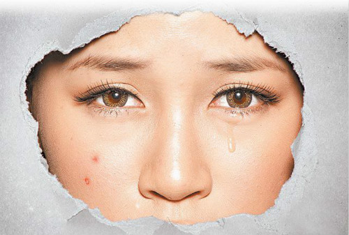 拒當(dāng)「痘花妹」！看痘痘生長(zhǎng)的位置判斷也許是身體出了問題