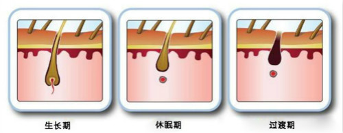 激光脫毛一次多少錢？能維持多久？