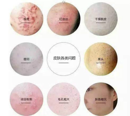 你知道補(bǔ)水對(duì)皮膚到底有多重要嗎？
