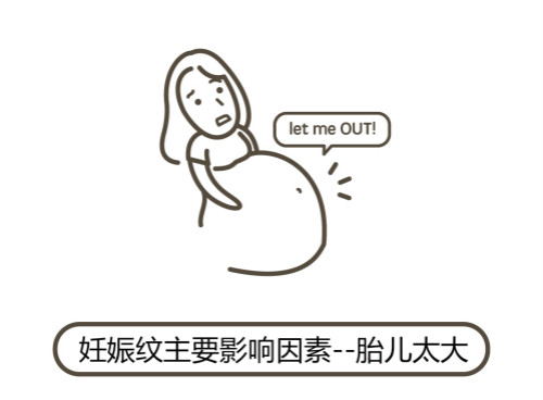 一文秒懂！妊娠紋肥胖紋保養(yǎng)、治療及預(yù)防全攻略