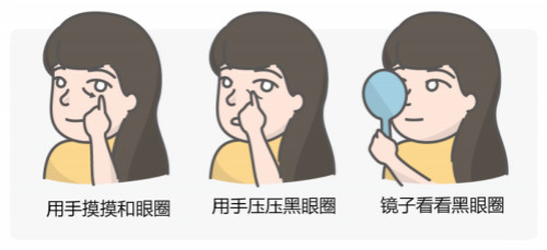 區(qū)分黑眼圈！黑眼圈的成因、分類、預(yù)防與治療全攻略