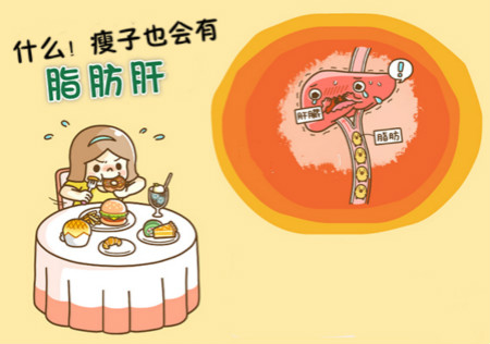 什么！瘦子也會有「脂肪肝」？