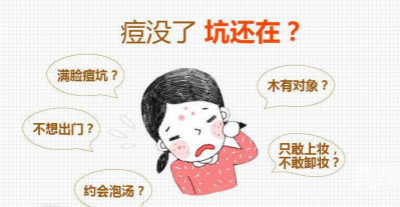 激光去痘印方法你適合嗎？