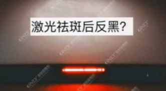 激光祛斑之后皮膚會反黑？美容儀器廠家教你這樣預(yù)防