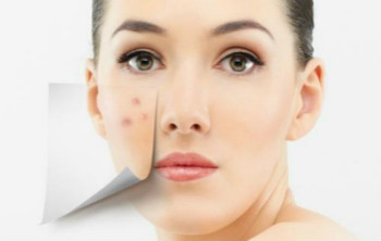 原來痘痘長不停是「枕頭」害的？5個(gè)你可能不知道的護(hù)膚秘訣
