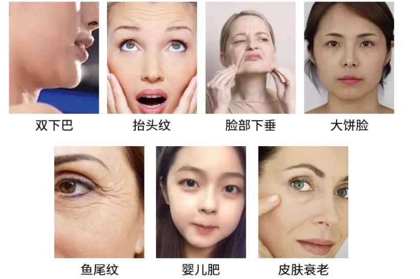 美容儀廠家教您怎么預(yù)防臉上長(zhǎng)斑，要注意什么?