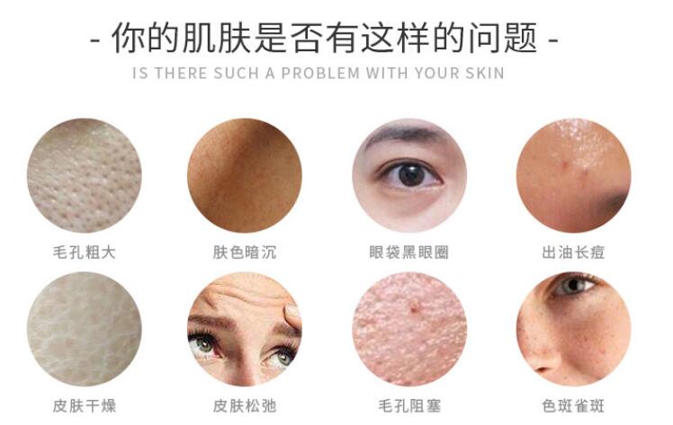 光子嫩膚美容儀器的美容效果和存在的風(fēng)險(xiǎn)！