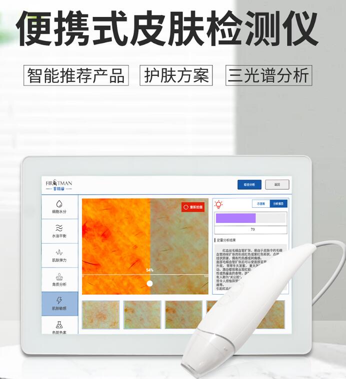 皮膚檢測(cè)美容儀，愛(ài)美第一步！
