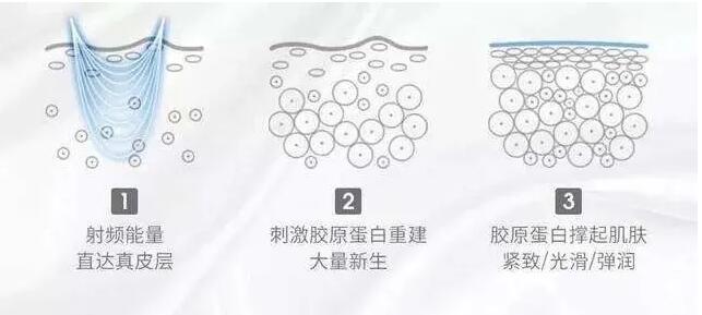 家用射頻美容儀怎么選？小心交了智商稅！