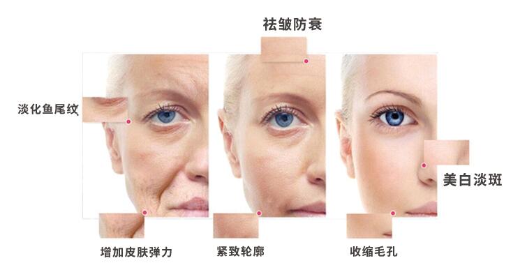 射頻美容儀的試用注意事項(xiàng)都有哪些？